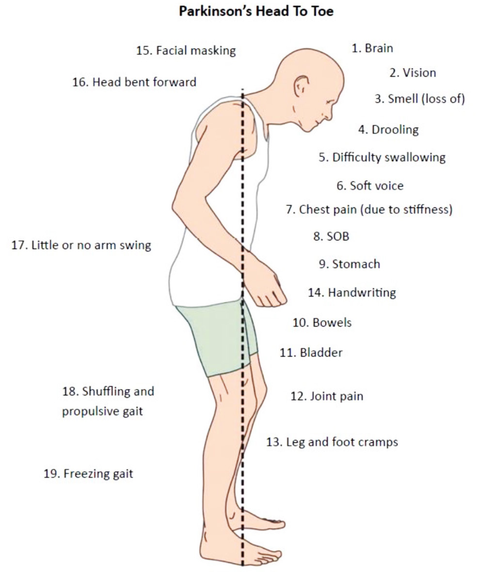 Symptoms of Parkinson's